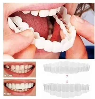 Miniatura 1 de CARILLAS DENTALES